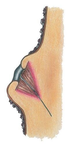Propagation des microorganismes 